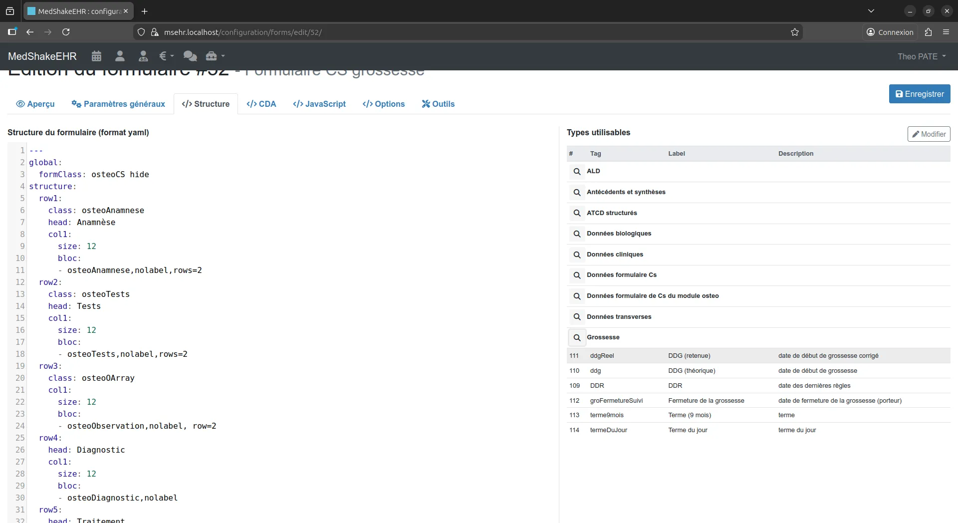 Interface d'édition de formulaire